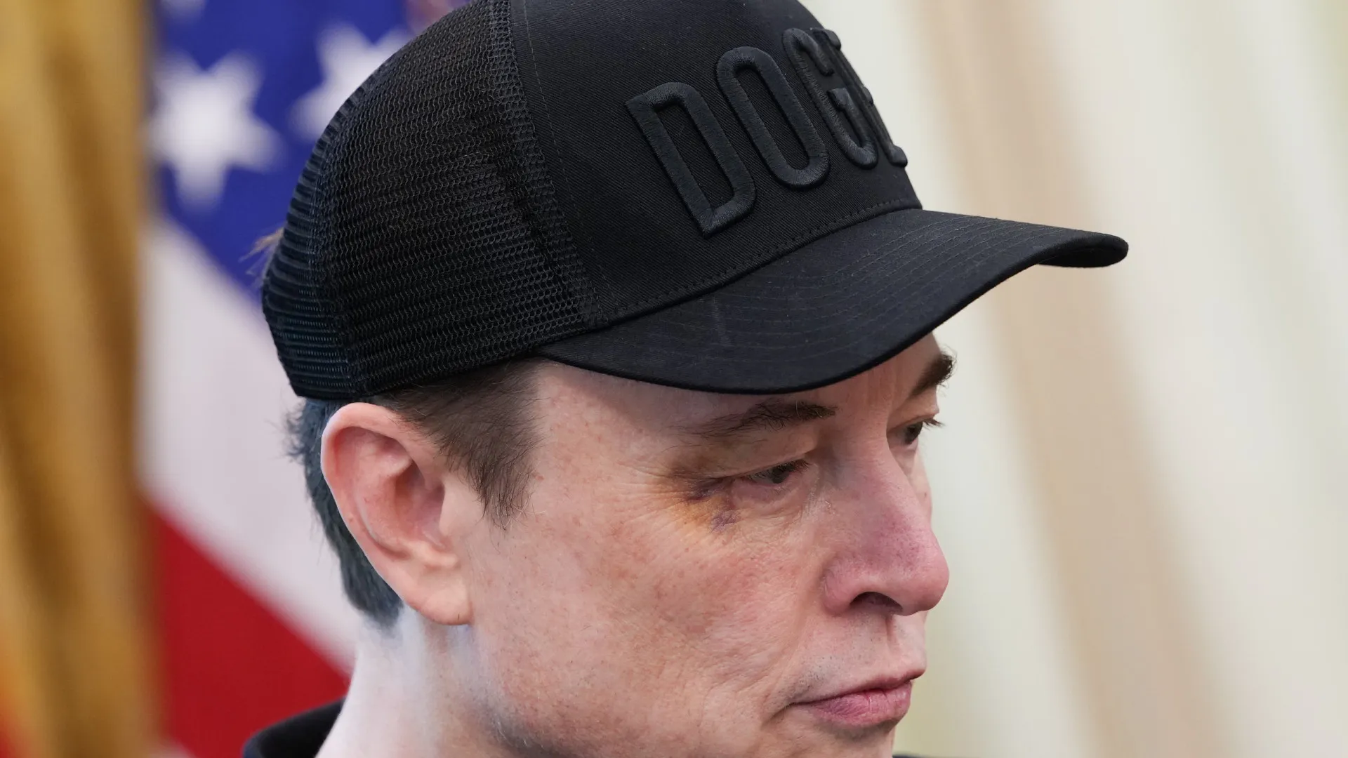"Disse para me dar soco e ele deu": olho roxo de Musk chama a atenção