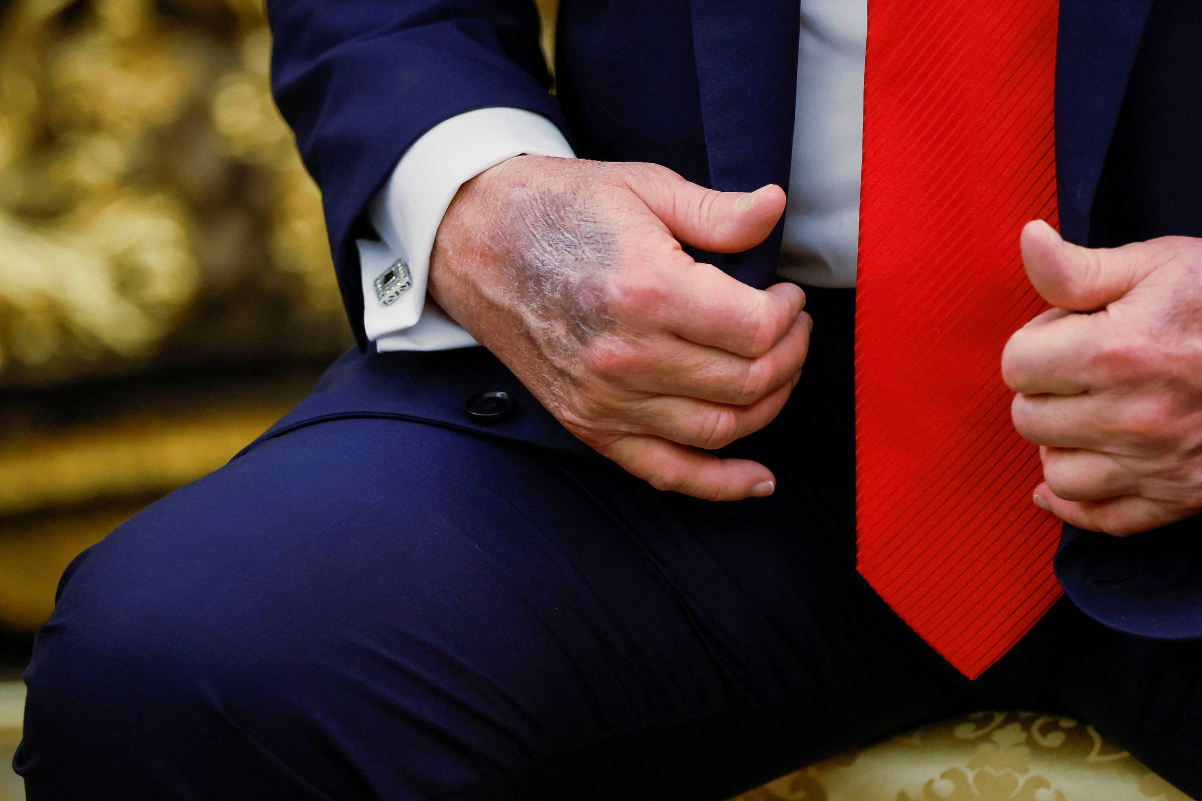 A imagem mostra as mãos de uma pessoa vestindo um terno escuro e uma gravata vermelha. A mão esquerda está segurando a mão direita, que está apoiada sobre a perna. O punho da camisa branca é visível, com um detalhe de abotoadura. O fundo é desfocado, mas parece ser um ambiente formal.